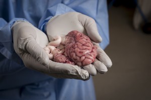 This pig brain will provide researchers with cells that are crucial in helping to get the medicine across the blood-brain barrier. Photo: Geir Otto Johansen.