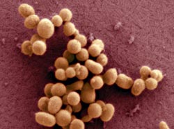 Craig Venter skapte «Synthia», en helt ny organisme, gjennom å bruke en bakterie som «kart» for arbeidet sitt, og lyktes i å konstruere, produsere og lime sammen et komplett syntetisk kromosom i en vertsbakterie.  Foto: J. Craig Venter Institute