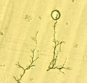 Slik ser "trærne" ut i mikroskopet. Dukker de opp, er det ikke lenge til en kortslutning skjer. Foto: SINTEF 