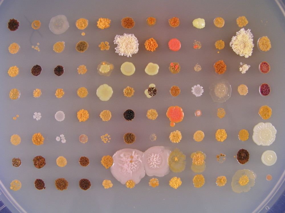 Bilde av bakteriekulturer med ulike farger