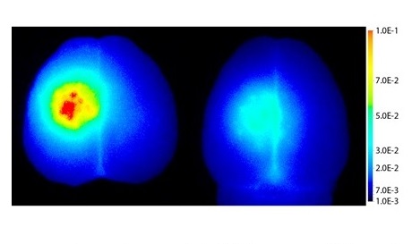 Illustrasjon 4: Bildet viser et fluorescerende makromolekyl i hjernevev. Til venstre: Hjernen er behandlet med ACT etter injeksjon av det fluorescerende molekylet. Til høyre ingen behandling etter injeksjon. Illustrasjon: NTNU 