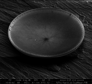 Mikroskopbilde av innsiden av algeskallets lokk. Nanostrukturene i skallet gjør at lys som trenger gjennom skallet ikke forsvinner ut igjen, men utnyttes fullt ut. Foto: NTNU NanoLab