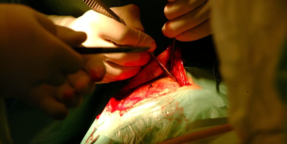 Nærbilde av kirurg-hender som operer i hodeskalle dekt av grønt klede