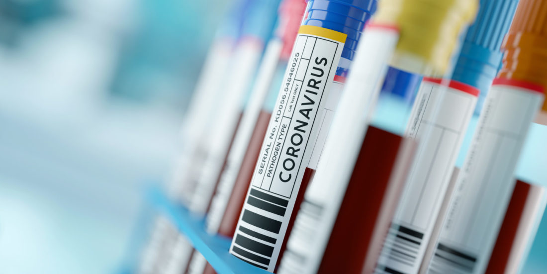 Coronavirus i reagensrør. Men hva med vaksinen?