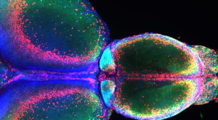 Habenula. Bildet viser habenula i hjernen til en sebrafisk.
