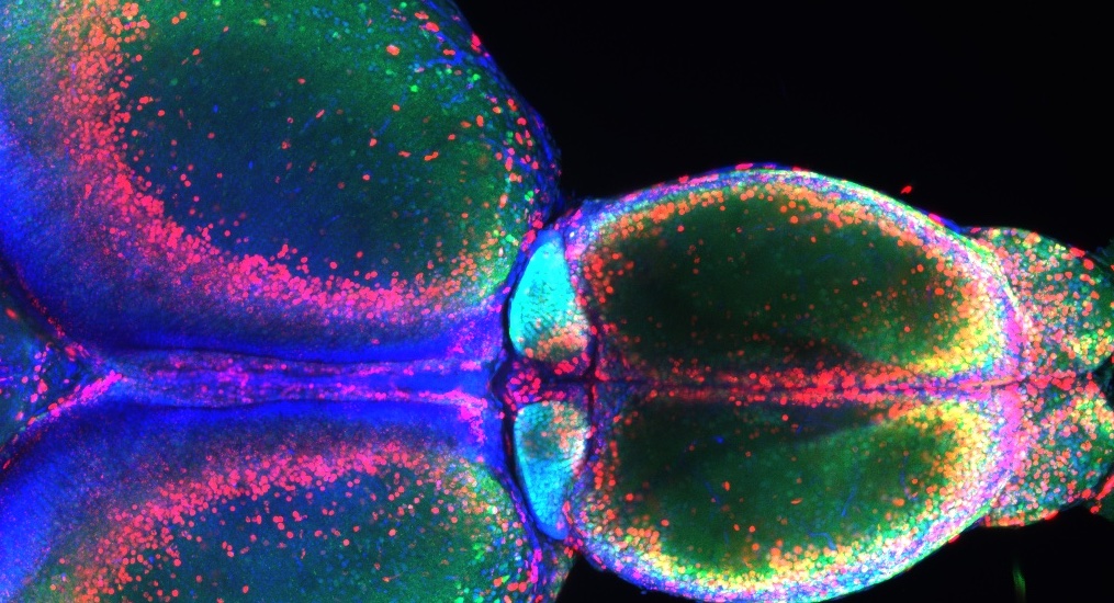 Habenula. Bildet viser habenula i hjernen til en sebrafisk.