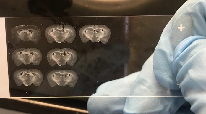 Alzheimers. Bildet viser hjerneprøver fra forsøksdyr.