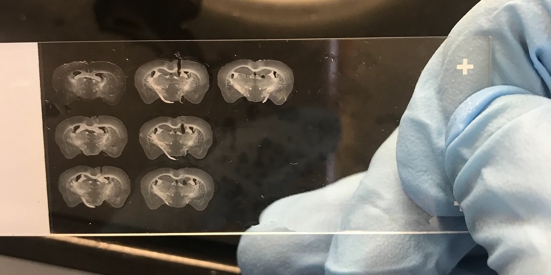 Alzheimers. Bildet viser hjerneprøver fra forsøksdyr.