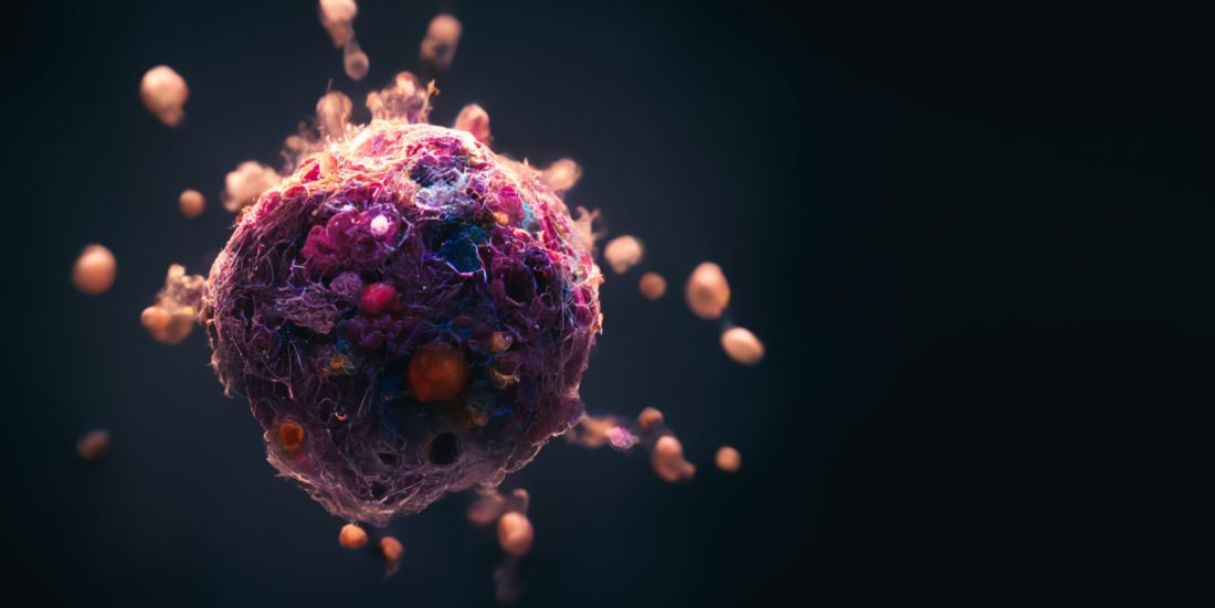 Kreftsvulst som angripes av nenokapsler. Illustrasjonsfoto: Shutterstock