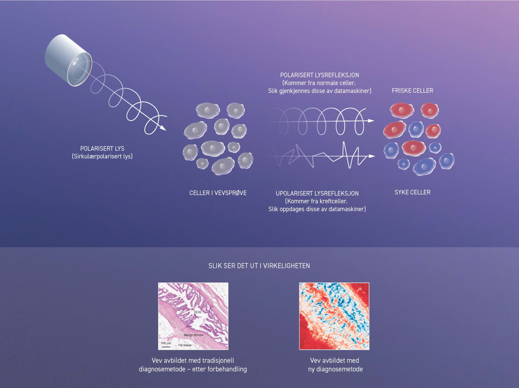 Illustrasjon som viser hvordan manipulert lys reflekteres fra friske celler vs. kreftceller