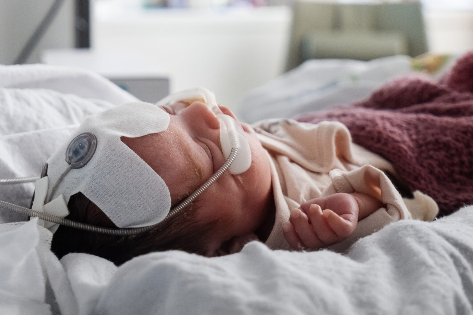 nyfødt baby med utstyr for pustehjelp