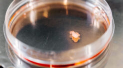 Bilde av en petriskål med en minihjerne. (finner behandling for sjeldne sykdommer)