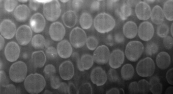 Bilde som viser tarmbakterier i elektronmikroskop. Artikkel om treflis og tarmbakterier som ble kunst.