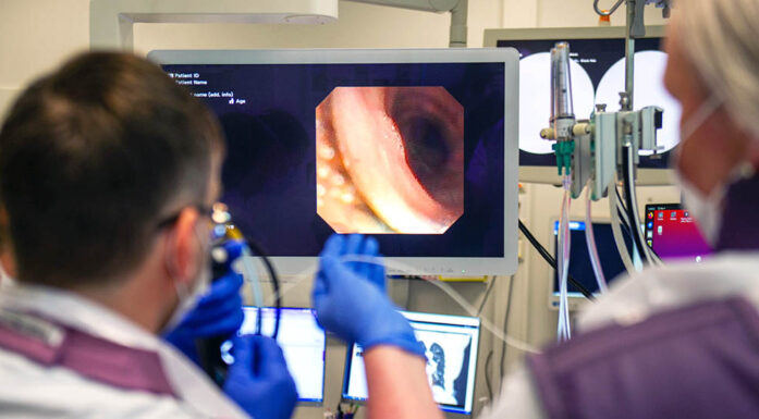 Et bronkoskop er en fleksibel kikkertslange med et kamera og lys i enden, som brukes til å undersøke luftveiene. Foto: Karoline Ravndal Lorentzen 