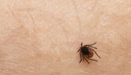 Ingen bevis for at hundrevis i Norge er langvarig syke på grunn av flått