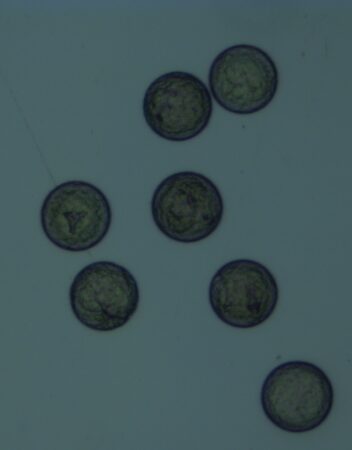 Raudåte. Bildet viser flere egg med ulike utviklingsstadier.