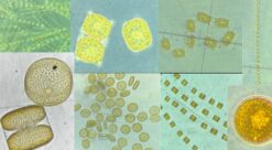 Slik ser de små algene ut gjennom linsa på et mikroskop. Foto: M2RG/UiT