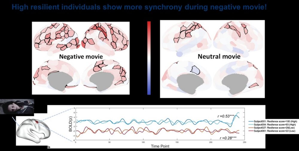 Hjernen. Bildet viser hjerneskanninger.